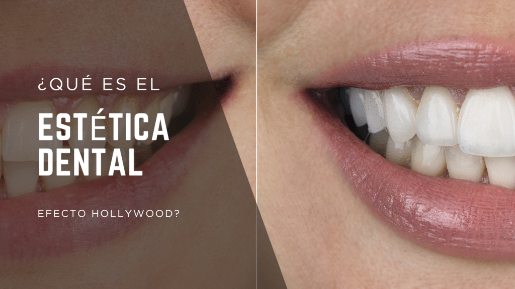 antes y despues del efecto hollywood